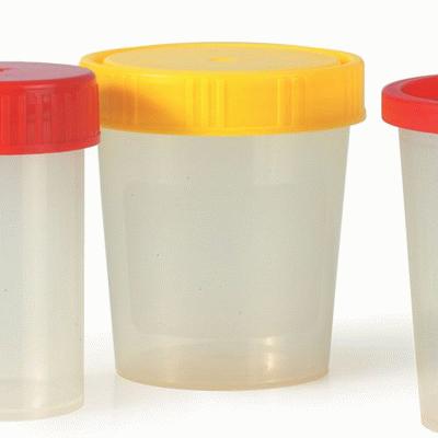 Urine Cups With Screw On Yellow Caps (10) Sterile